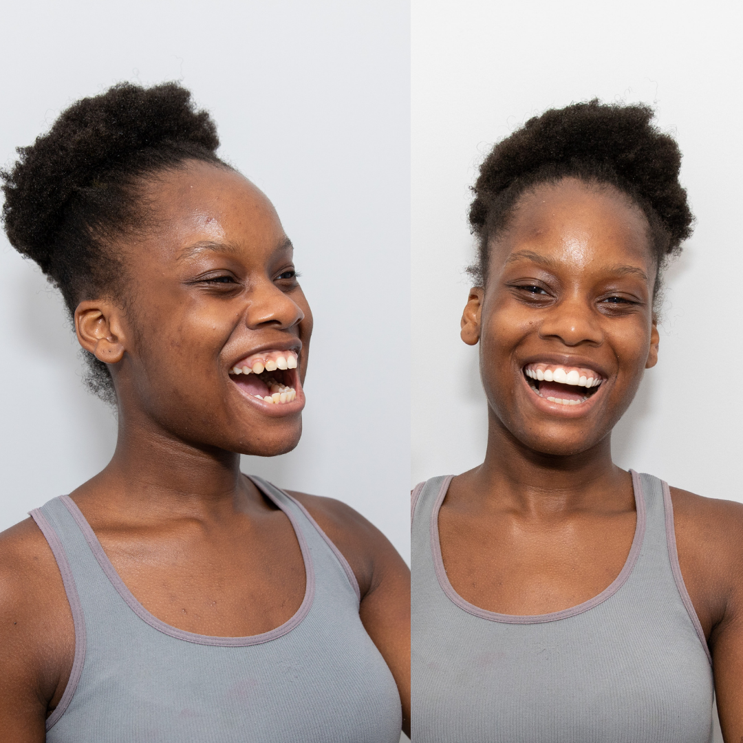 Oh, ¡tan uniforme y suave!