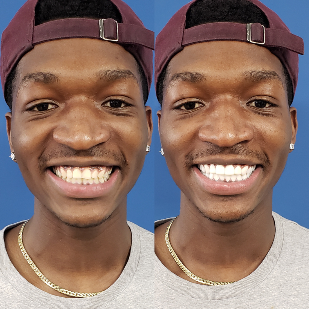 Definitely Smiling Now