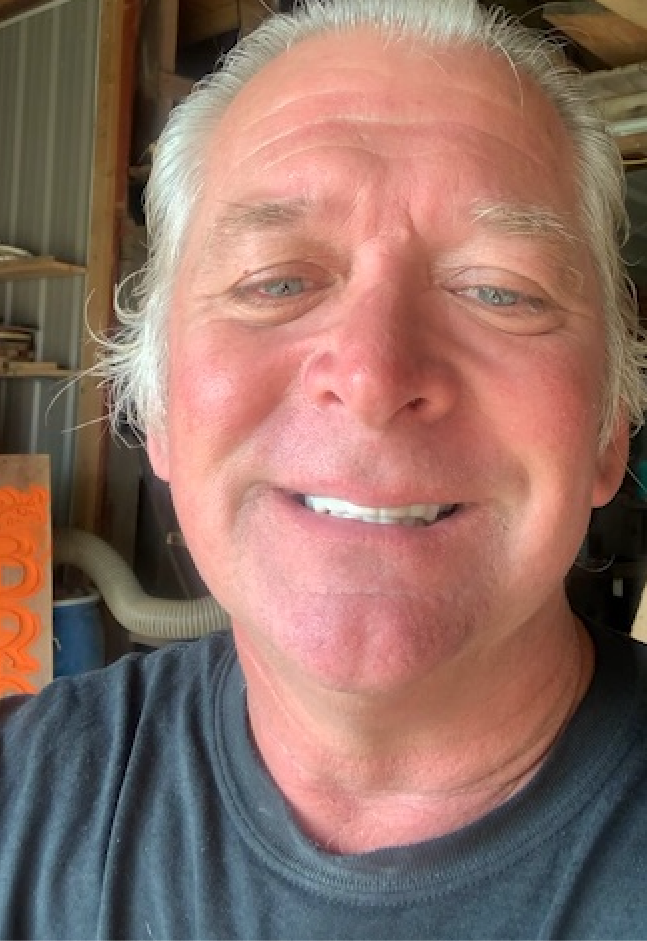 ¡WOW! ¡Qué diferencia en mi sonrisa!