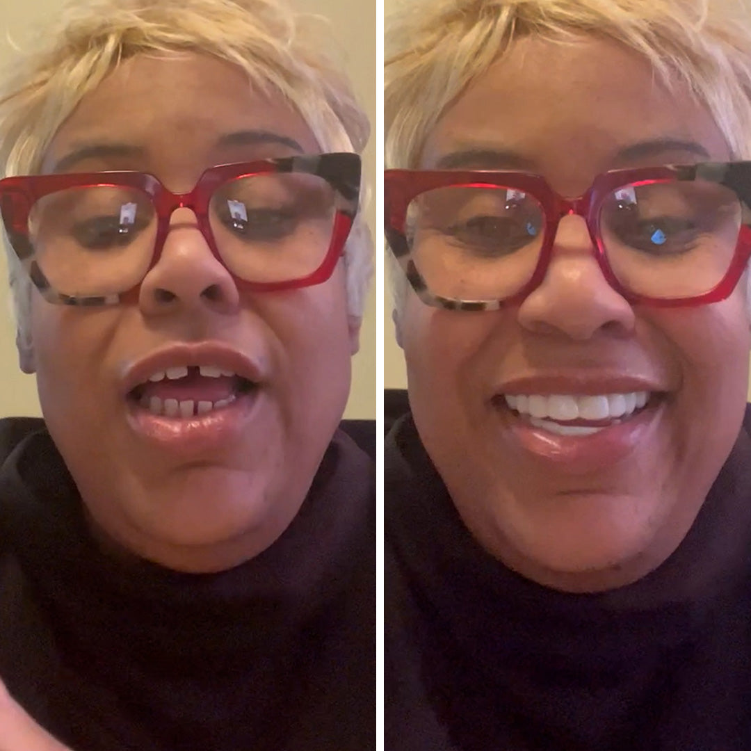 Consigue la sonrisa que siempre has deseado