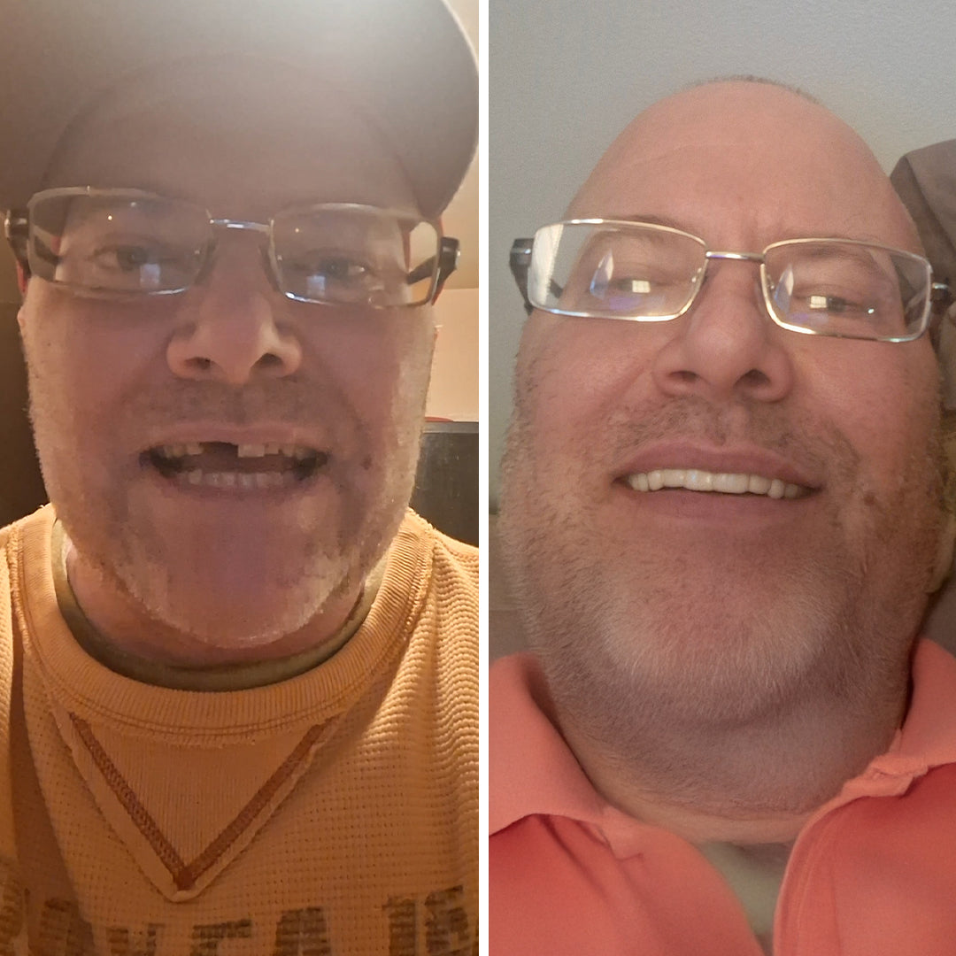 Transform your smile in seconds!