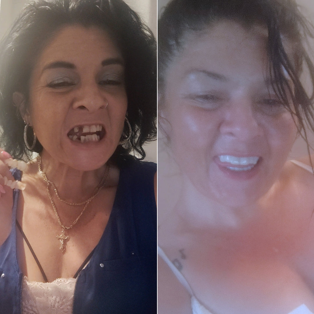 Perfect smile with Pop On!