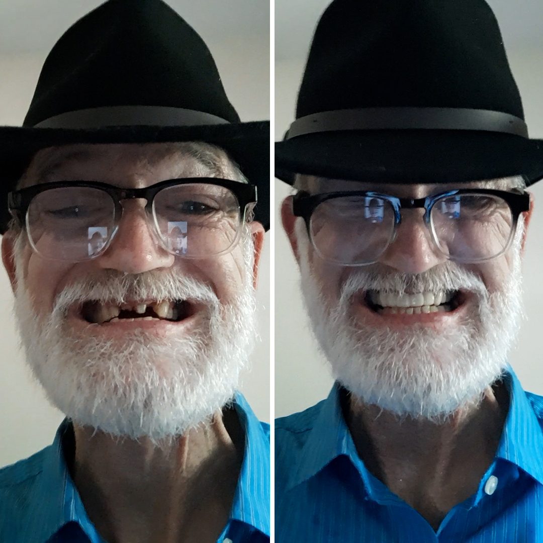 ¡WOW! ¡Increíble nueva sonrisa!