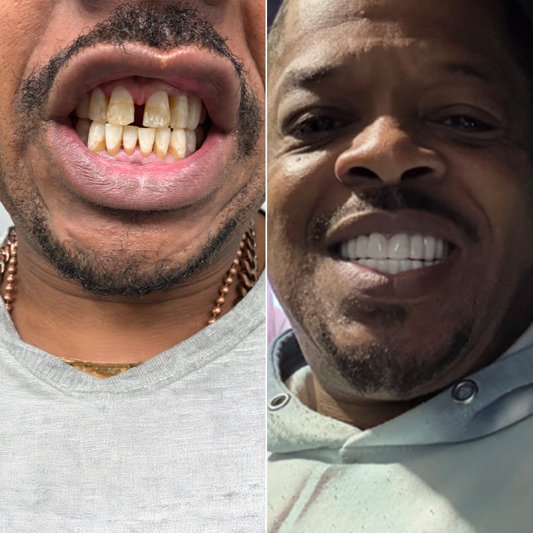 ¡Tengo una sonrisa de Hollywood!