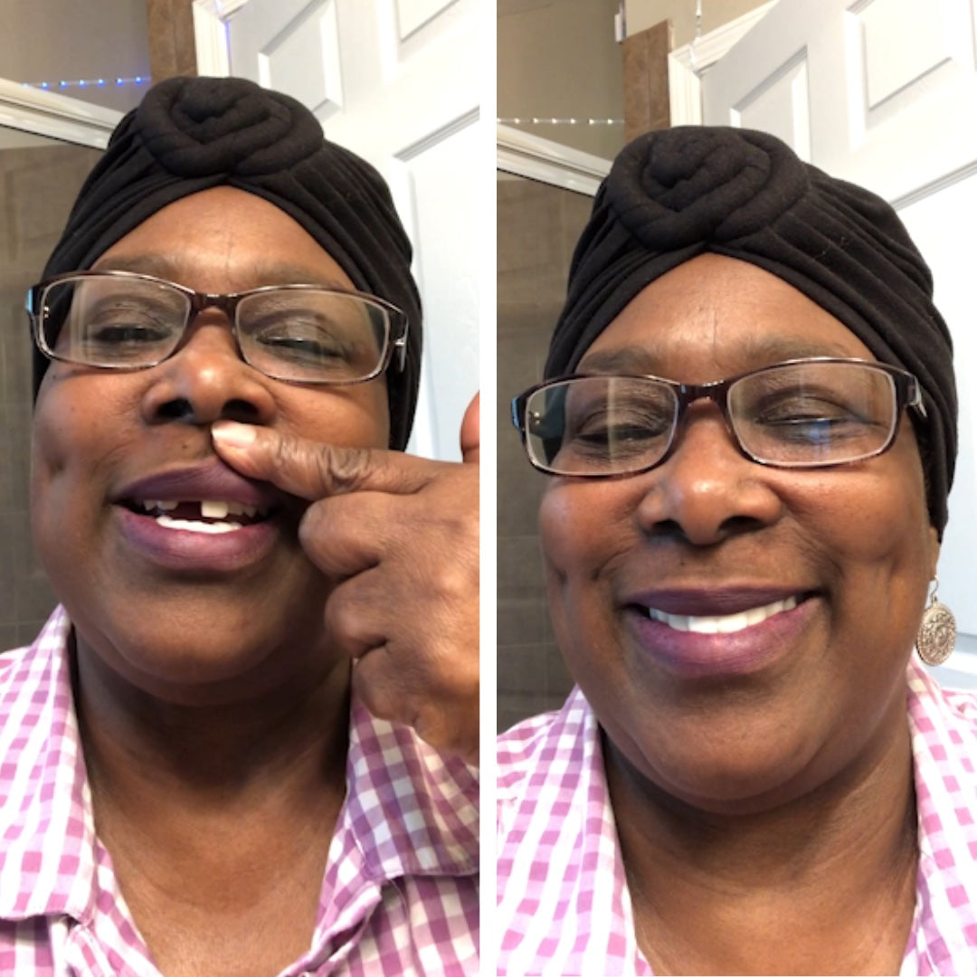 ¡Transformación de la sonrisa que cambia la vida!