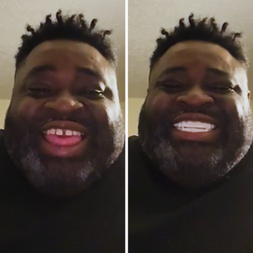 ¡He recuperado mi sonrisa como si fuera joven!