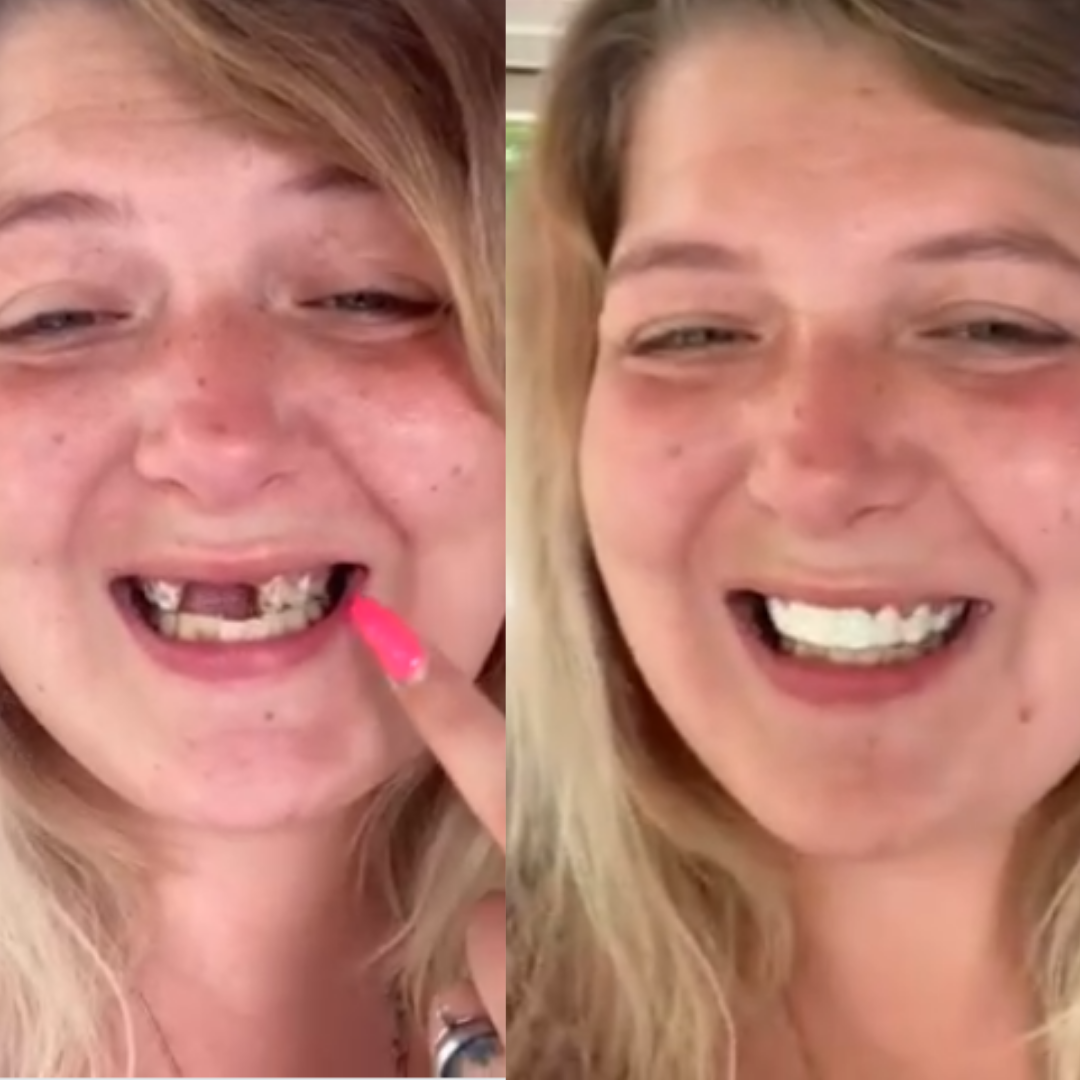 ¡Mira, puedo volver a sonreír!