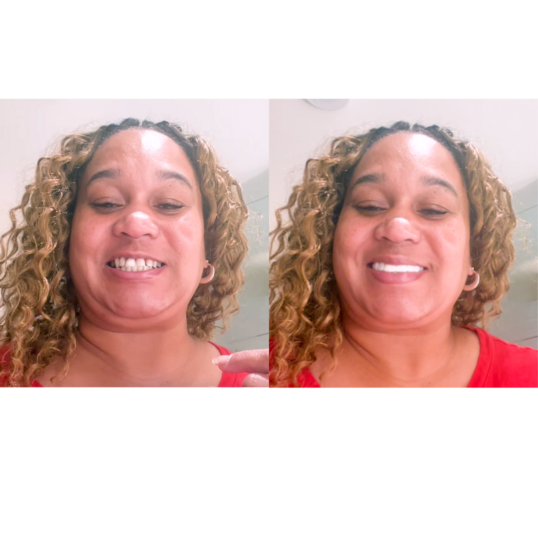 Al igual que esa sonrisa perfecta ¡BUM!