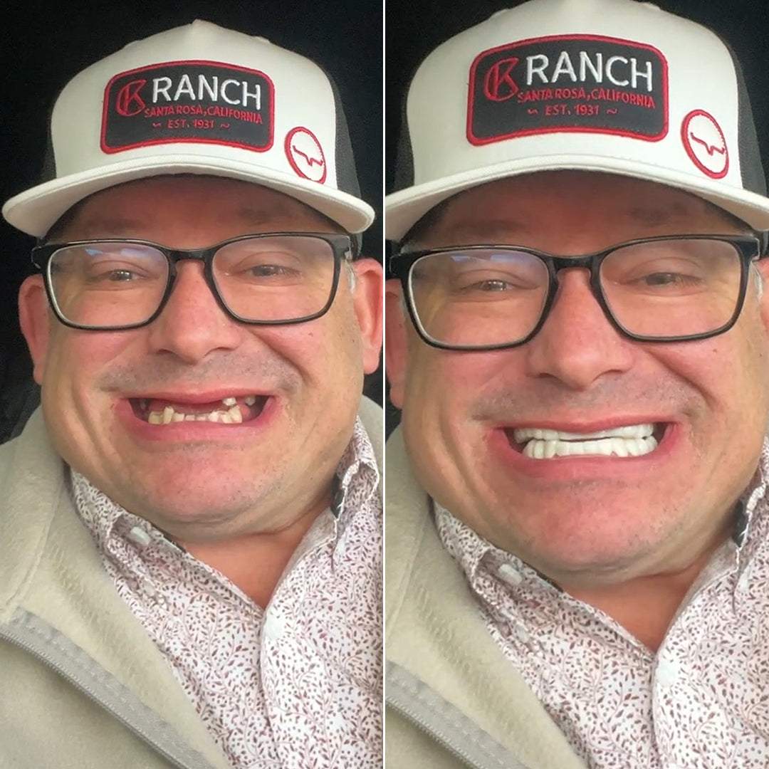 ¡Una mejora enorme en mi sonrisa!