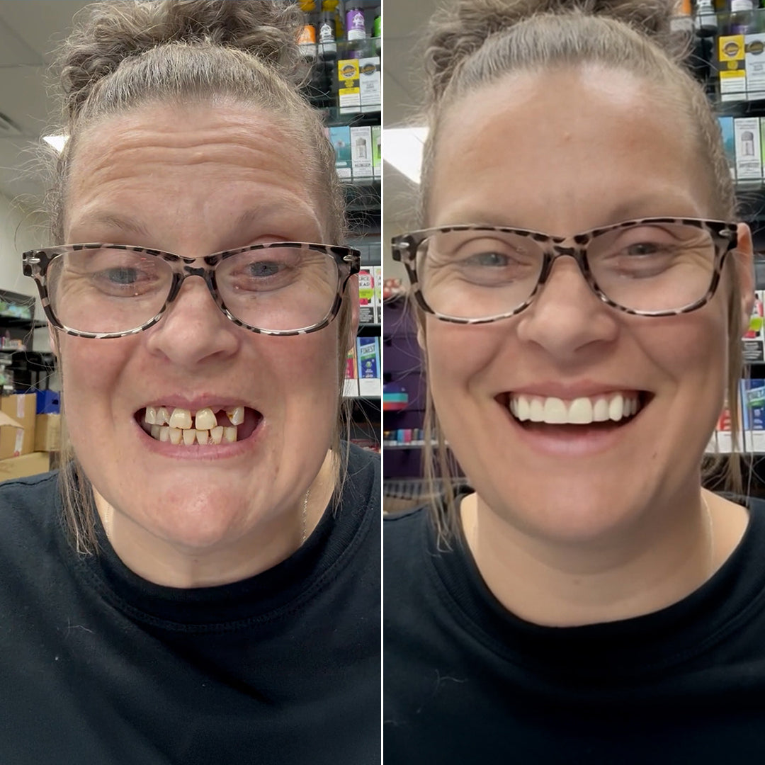 The fast, affordable way to get your dream smile!