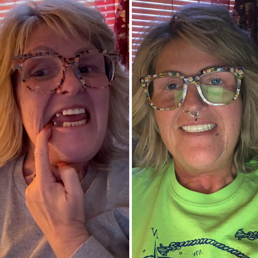 ¡A los profesionales dentales les encanta Pop On!