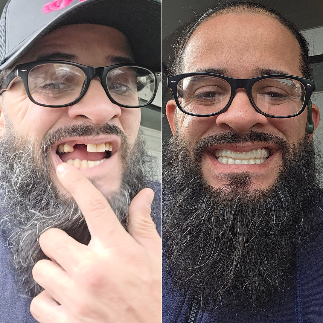 Game changer for my smile!