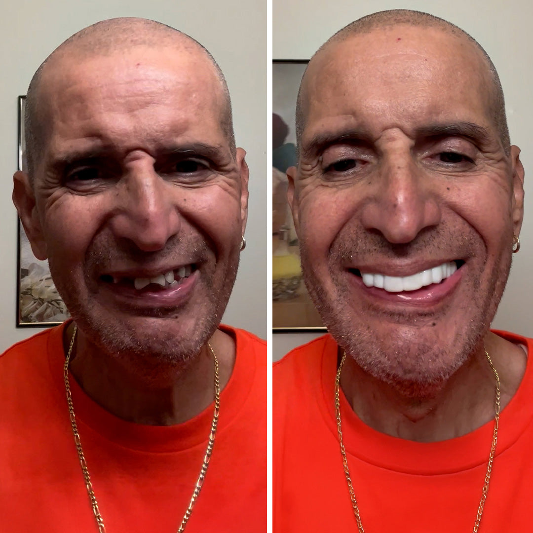 Smile transformation made simple!