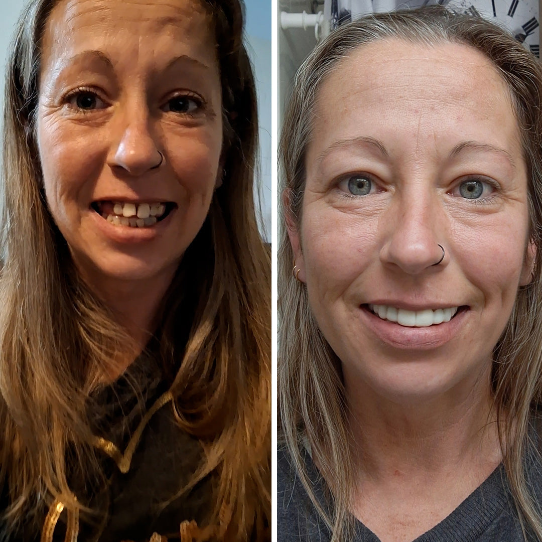 Es tan fácil recuperar la sonrisa.