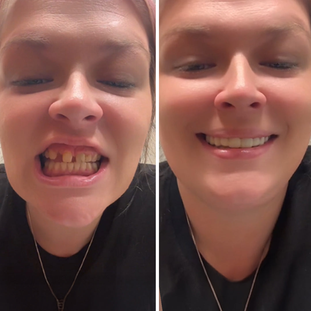 Feliz y confiado gracias a Pop On