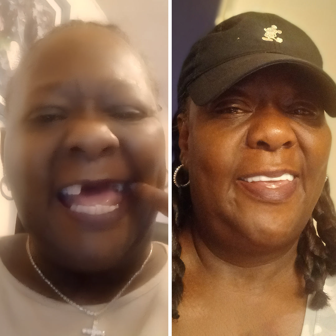 My smile transformation