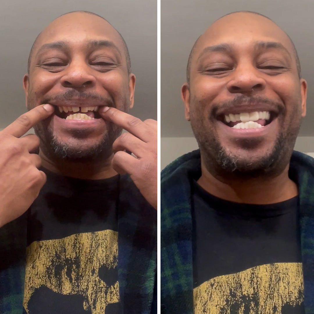 ¡Voilà! ¡Sonrisa perfecta!