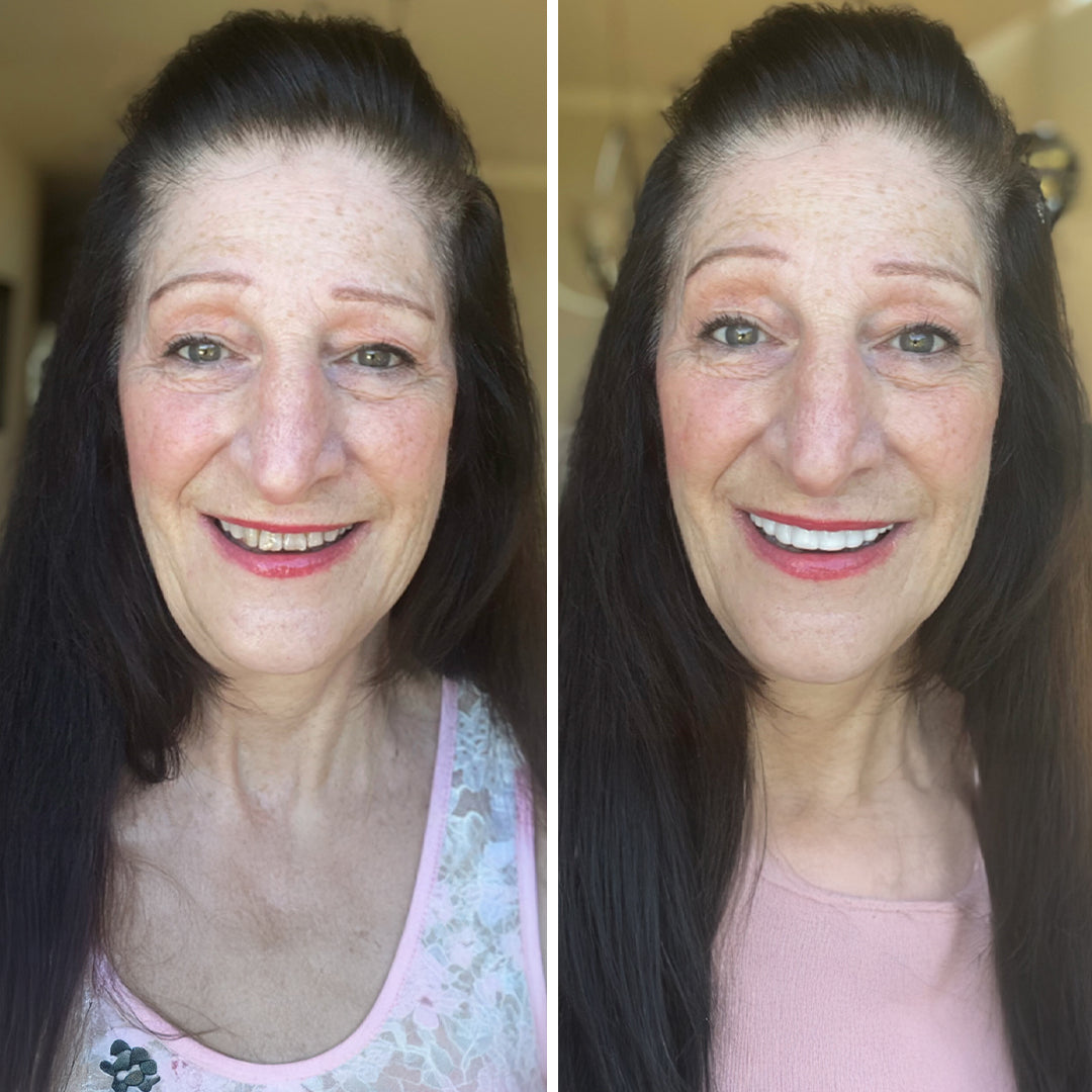 ¡¡La mejor decisión de mi vida!!