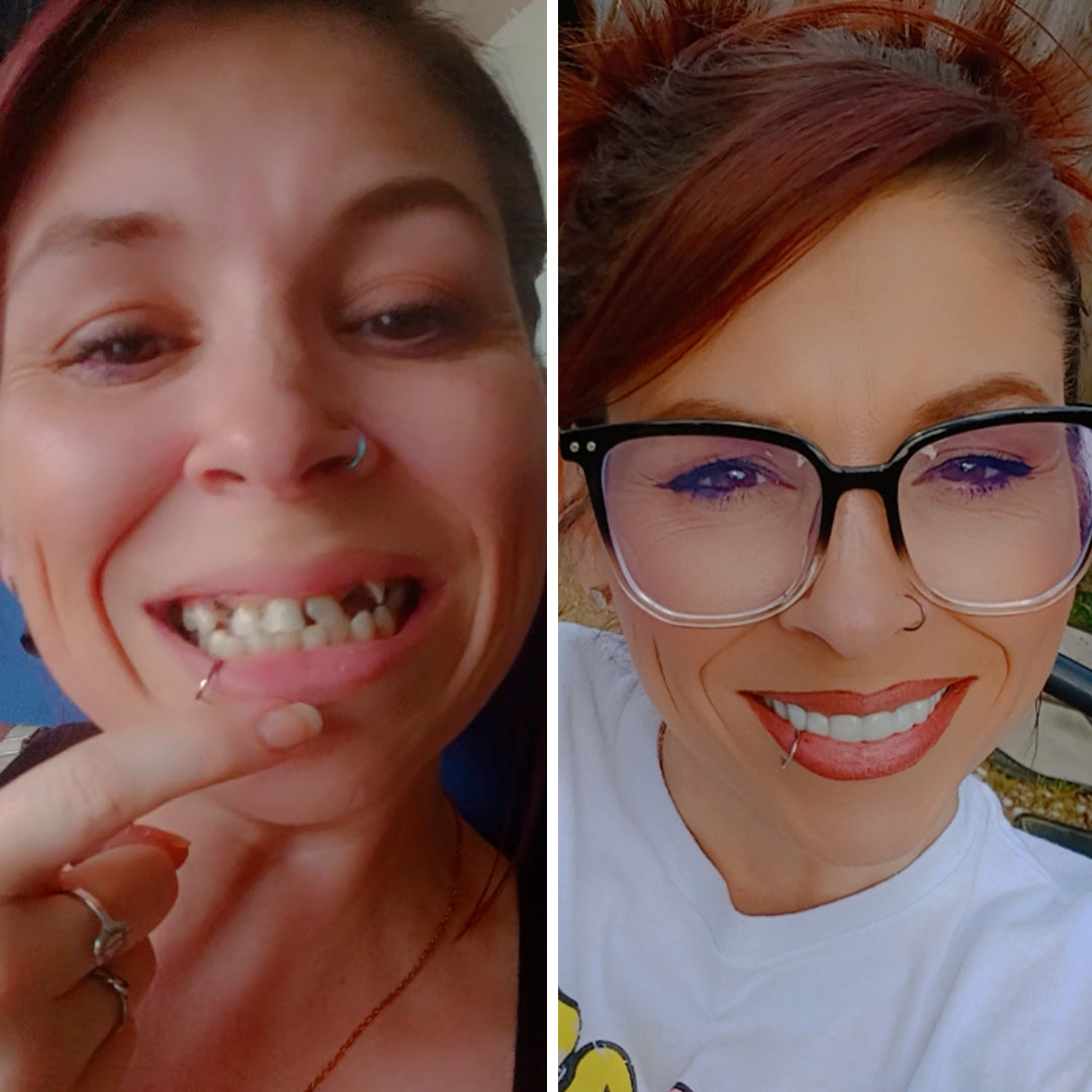 Hace años que no veo mi sonrisa