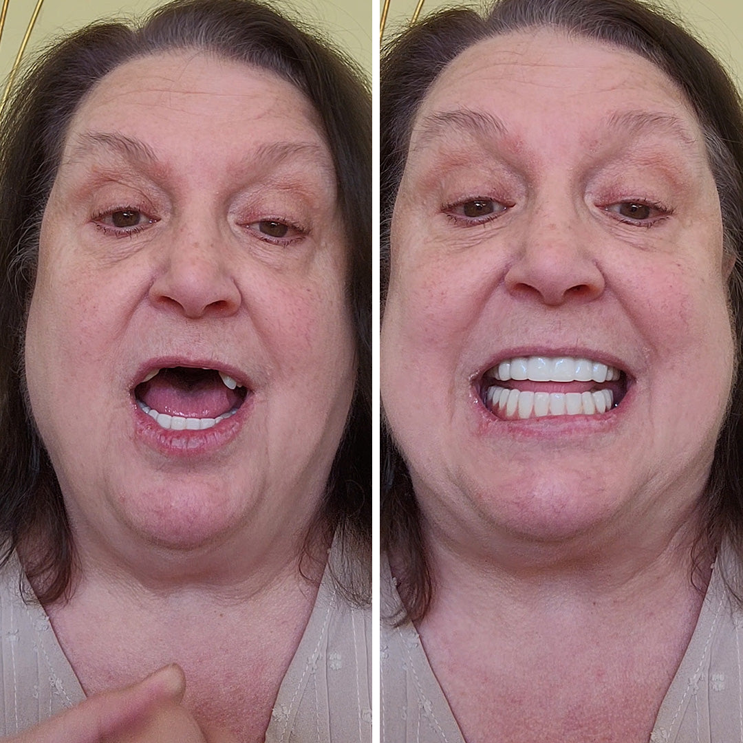 ¡Estoy TAN contenta con mi sonrisa!