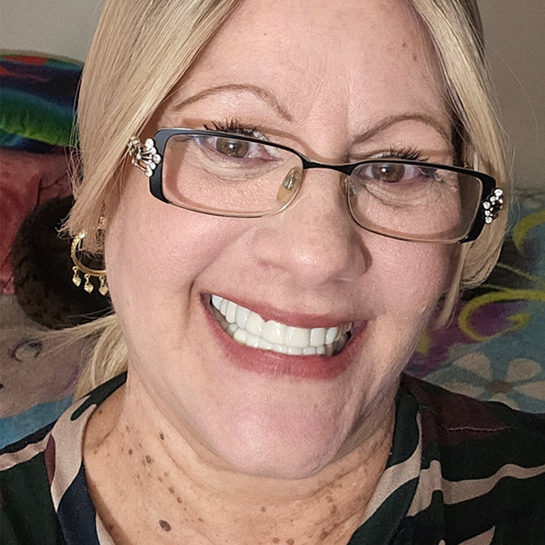 It’s a blessing to smile again!