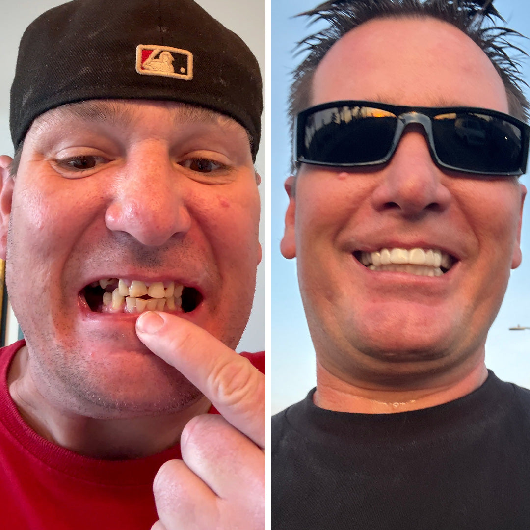 Check out my brand new smile!😎