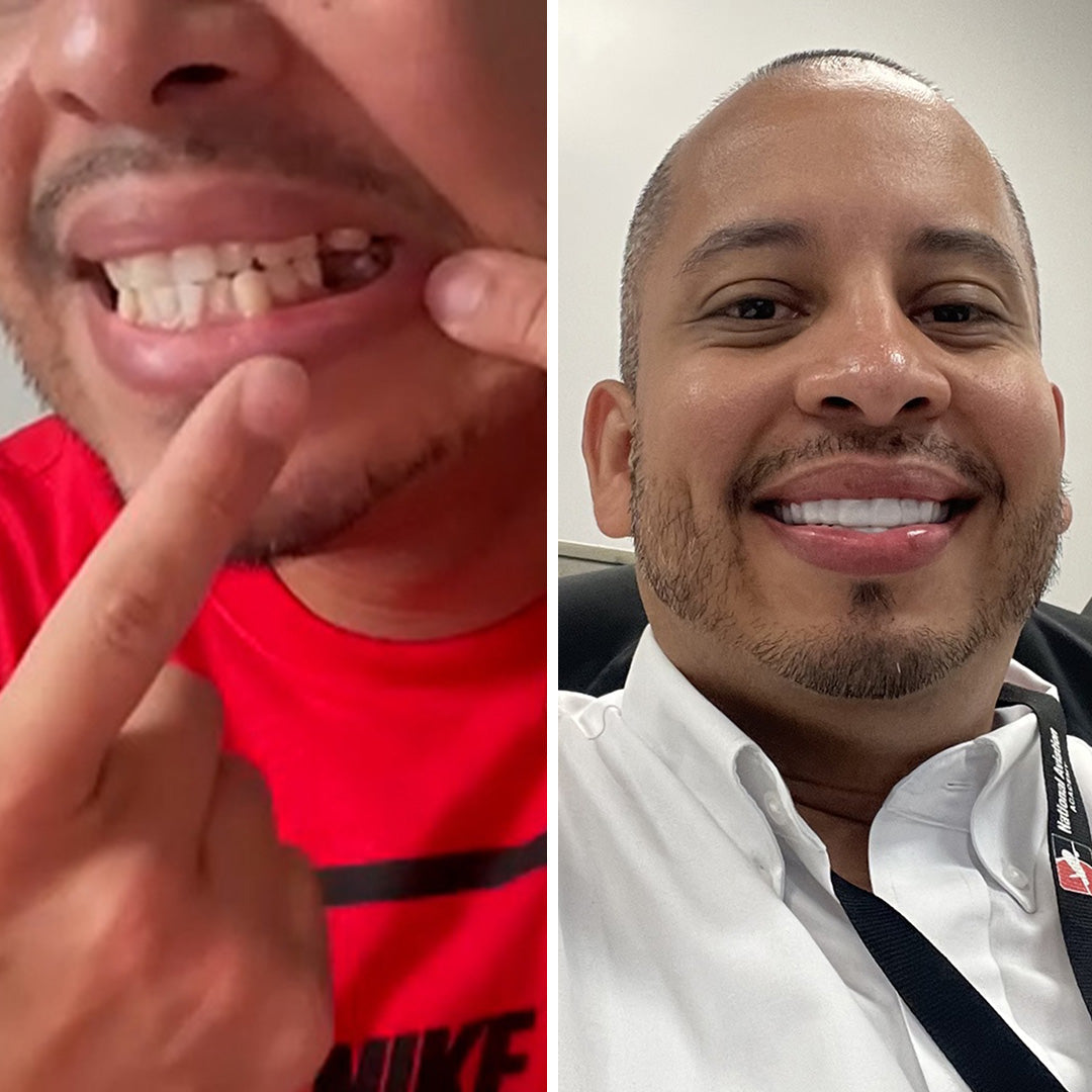 Una solución asequible para la sonrisa