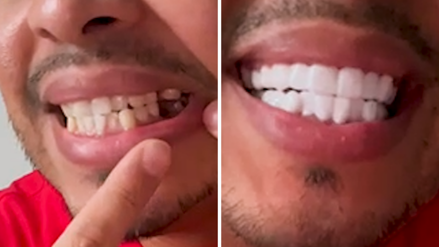 Mi sonrisa de Hollywood