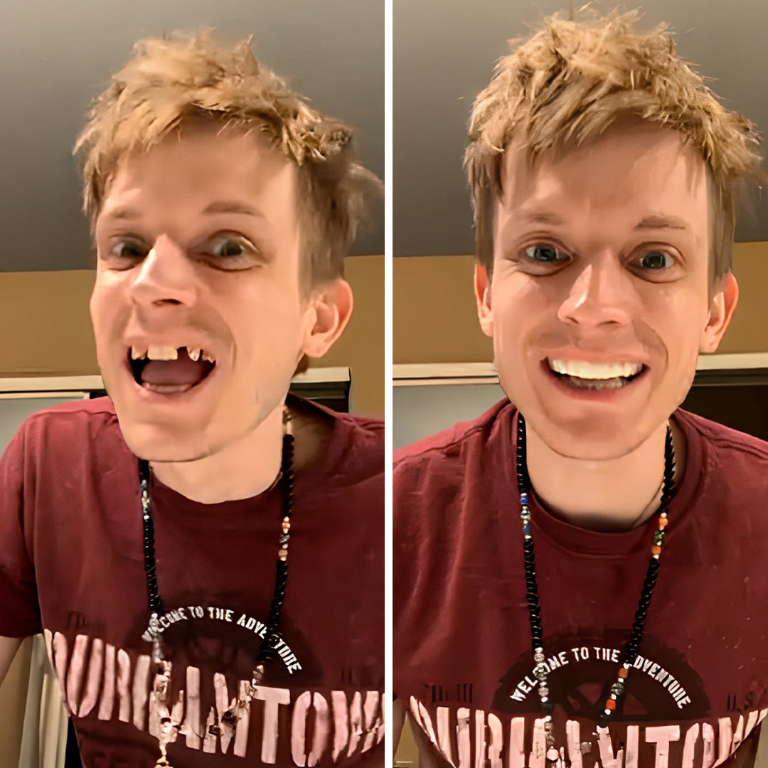 Nailed the interview with a new smile!