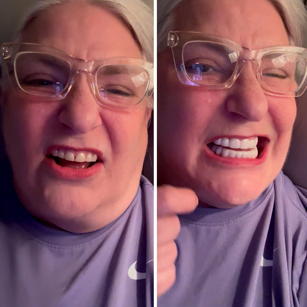 Totally thrilled with my new smile