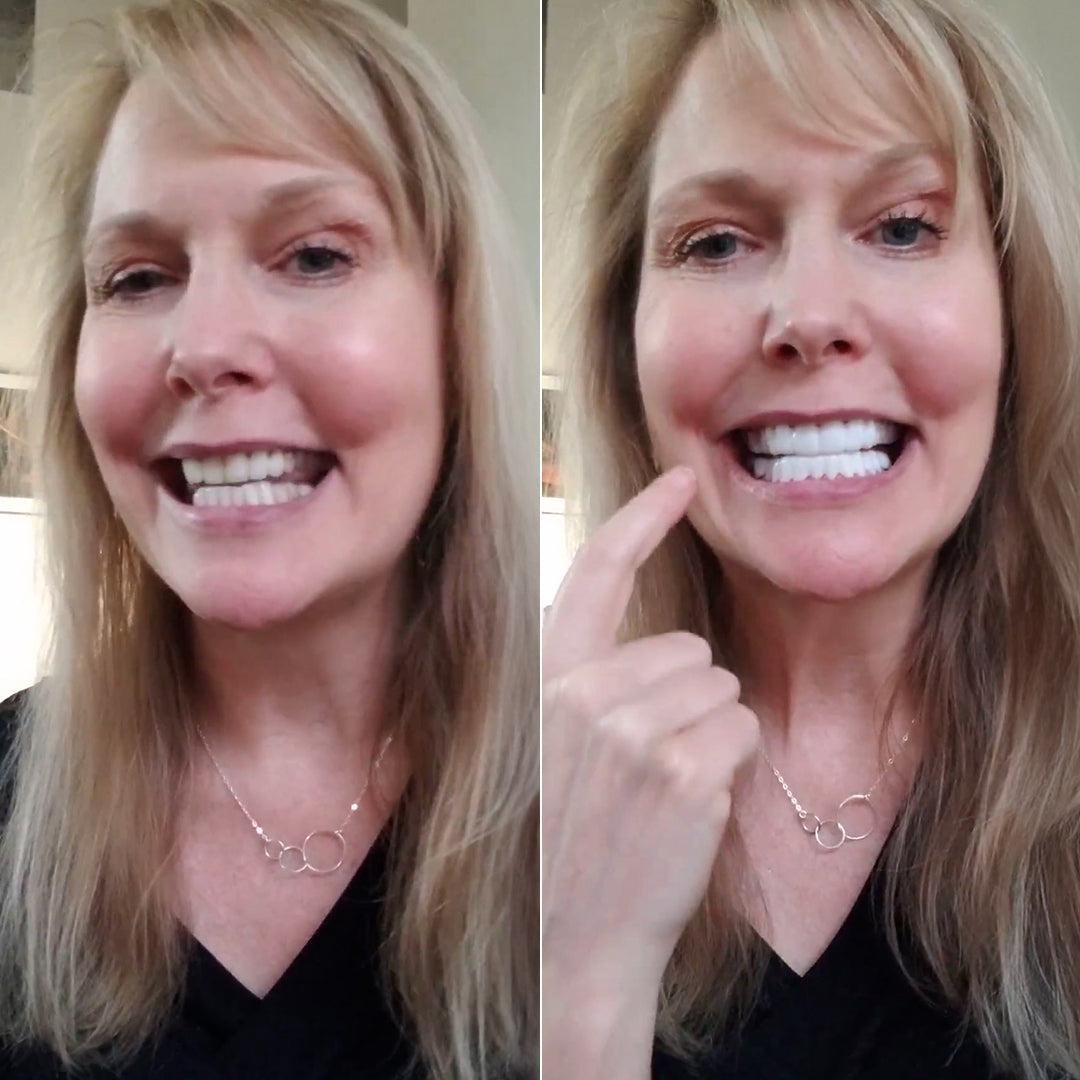 Honest review of Pop On Veneers