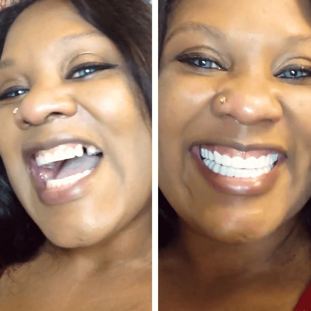 ¡Tengo mi sonrisa de Hollywood!