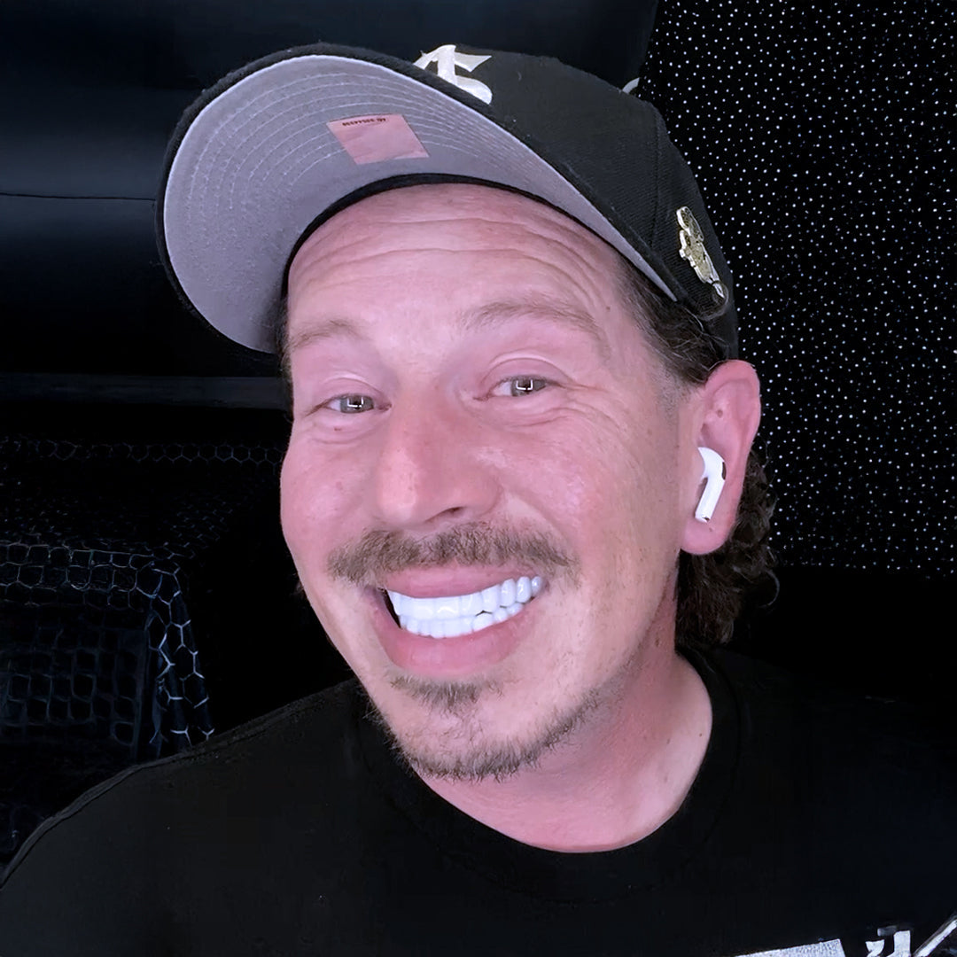 I have a celebrity smile now!