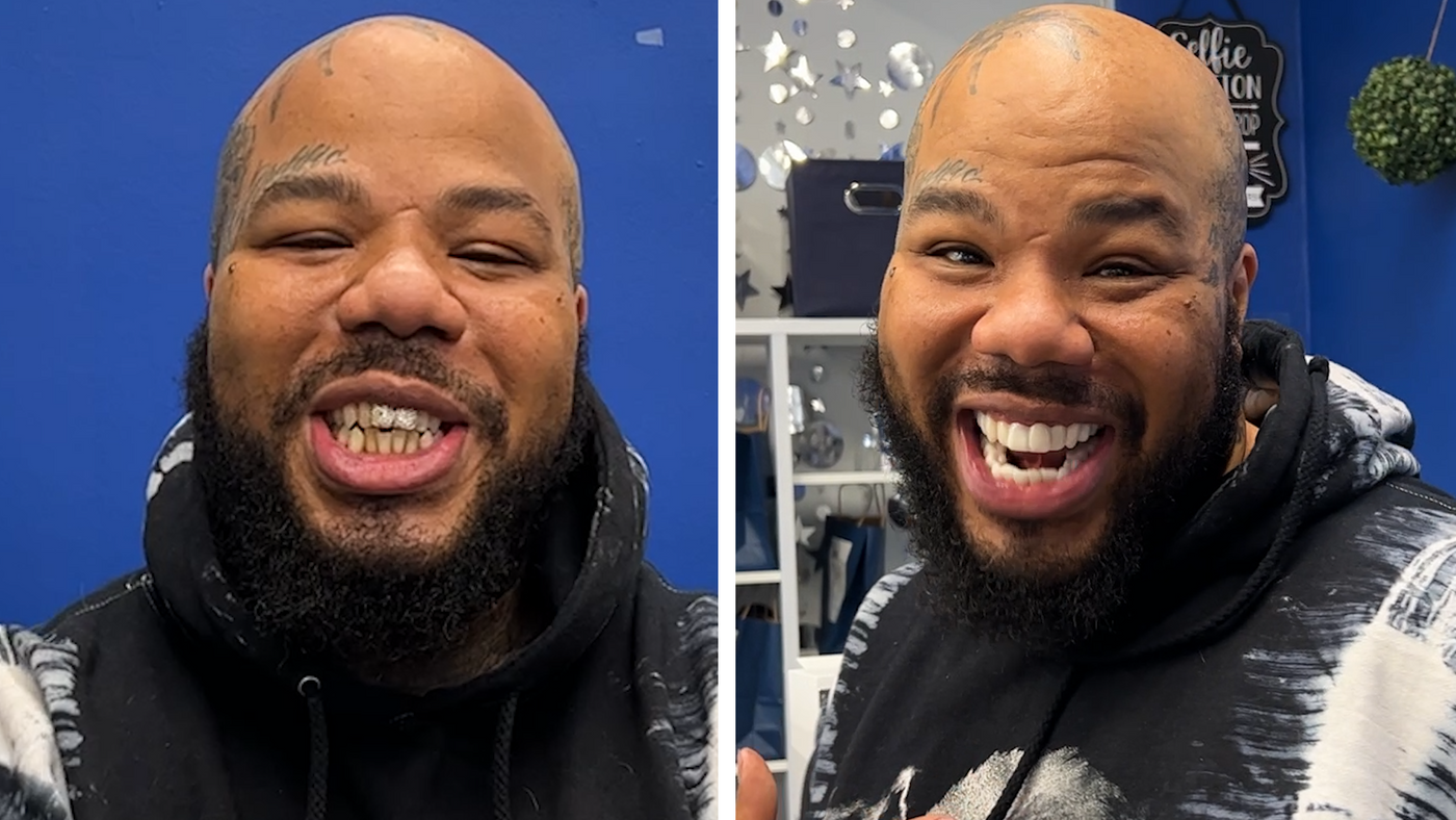 ¡La sonrisa de Spyder🕷️Dope!