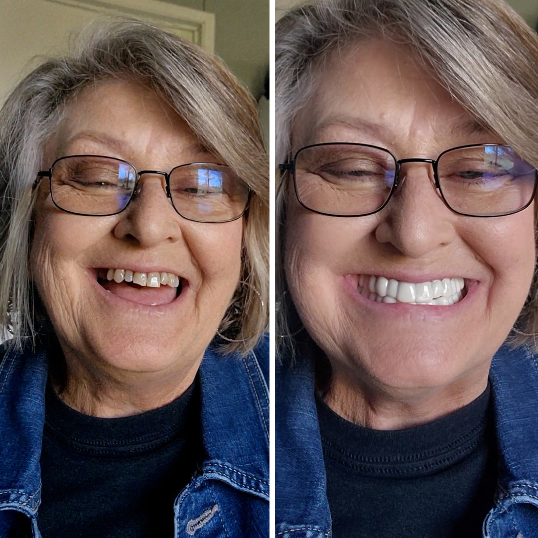 They pop on and they’re secure!