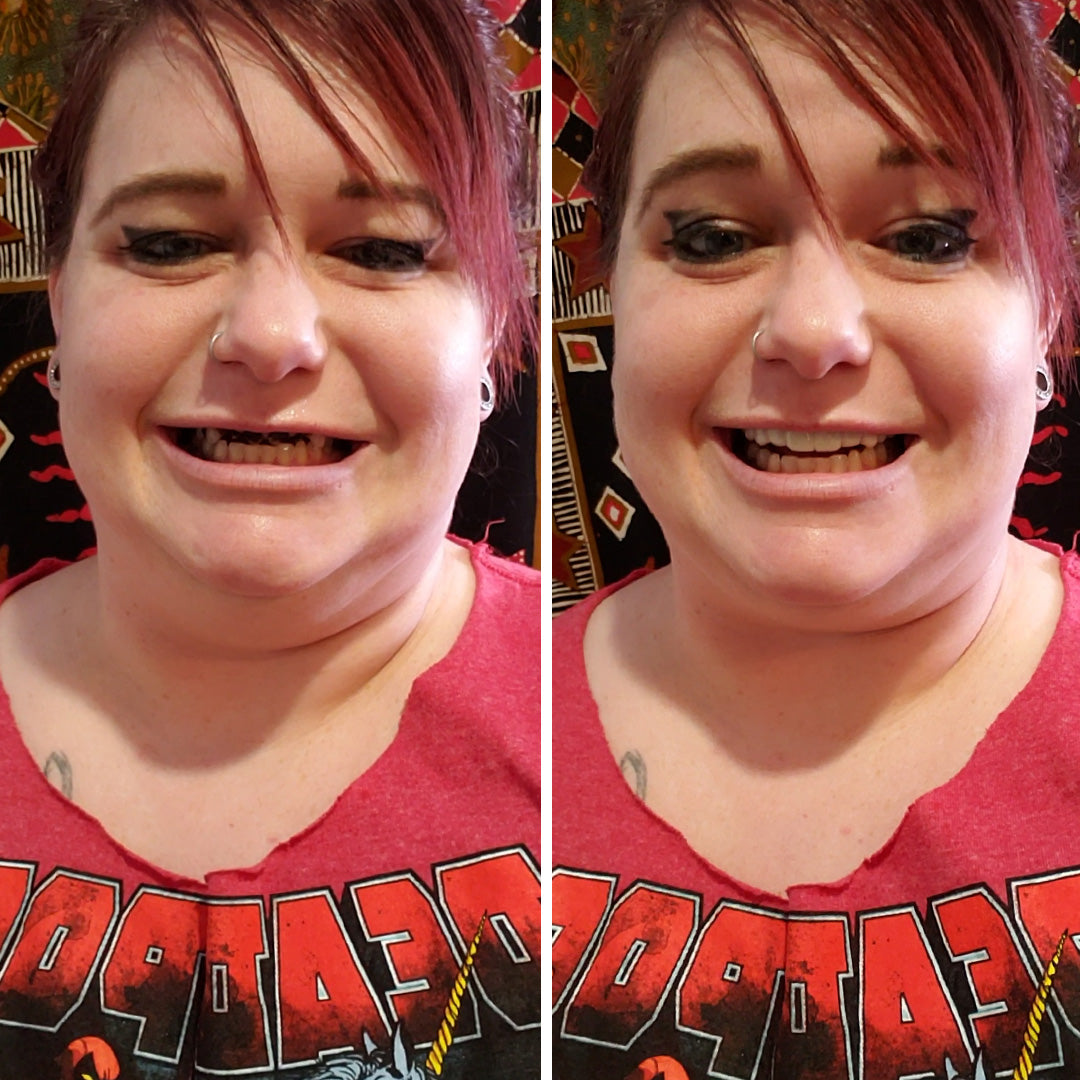 Por fin puedo volver a sonreír