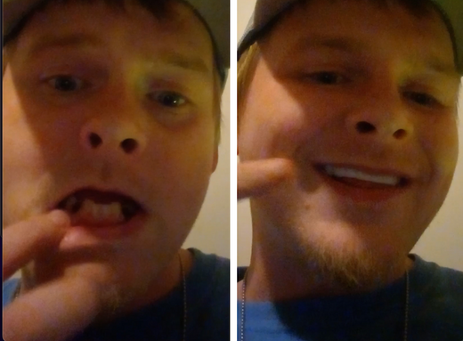 ¡Sonrisa increíble con Pop On!