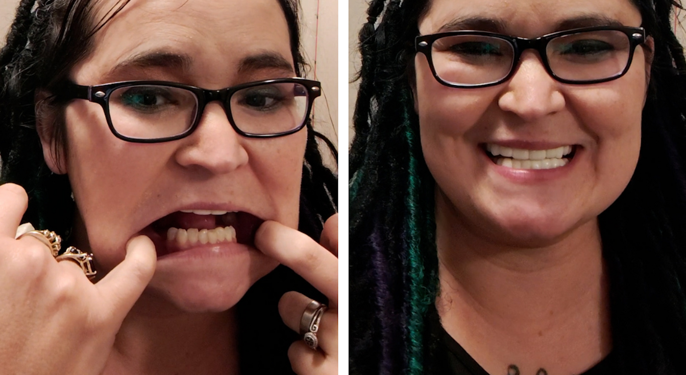 ¡Mira la diferencia en mi sonrisa!