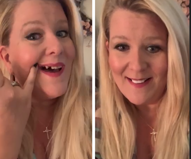 He recuperado mi bonita sonrisa.