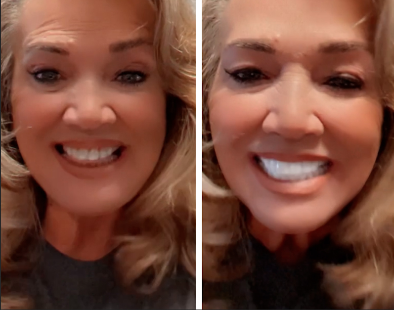 Mostrando mi nueva y bonita sonrisa.