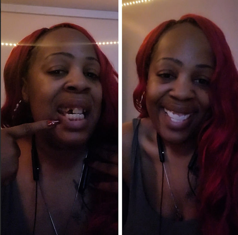 La diferencia es enorme.