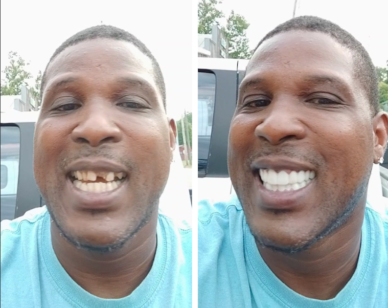 ¡Orgulloso usuario de Pop On Veneers!