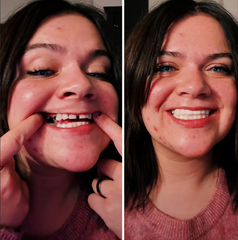 Puedo sonreír con confianza.