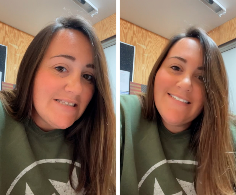 ¡Las Carillas Pop On son geniales!