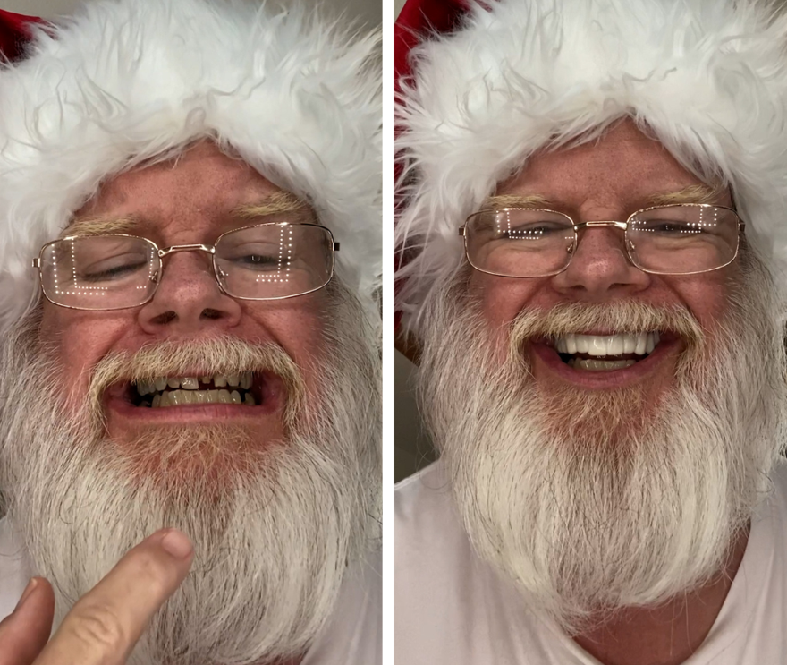 Echa un vistazo a la transformación de esta sonrisa.