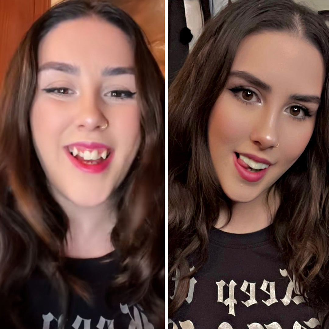 Estas chapas son LOCAS