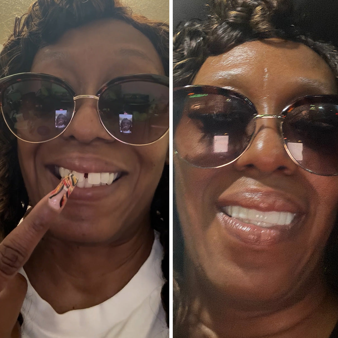 Me encanta mi sonrisa.