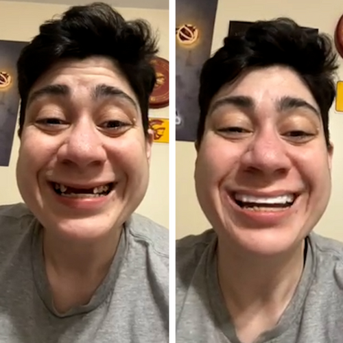 ¡Sonriendo de nuevo gracias a Pop On!