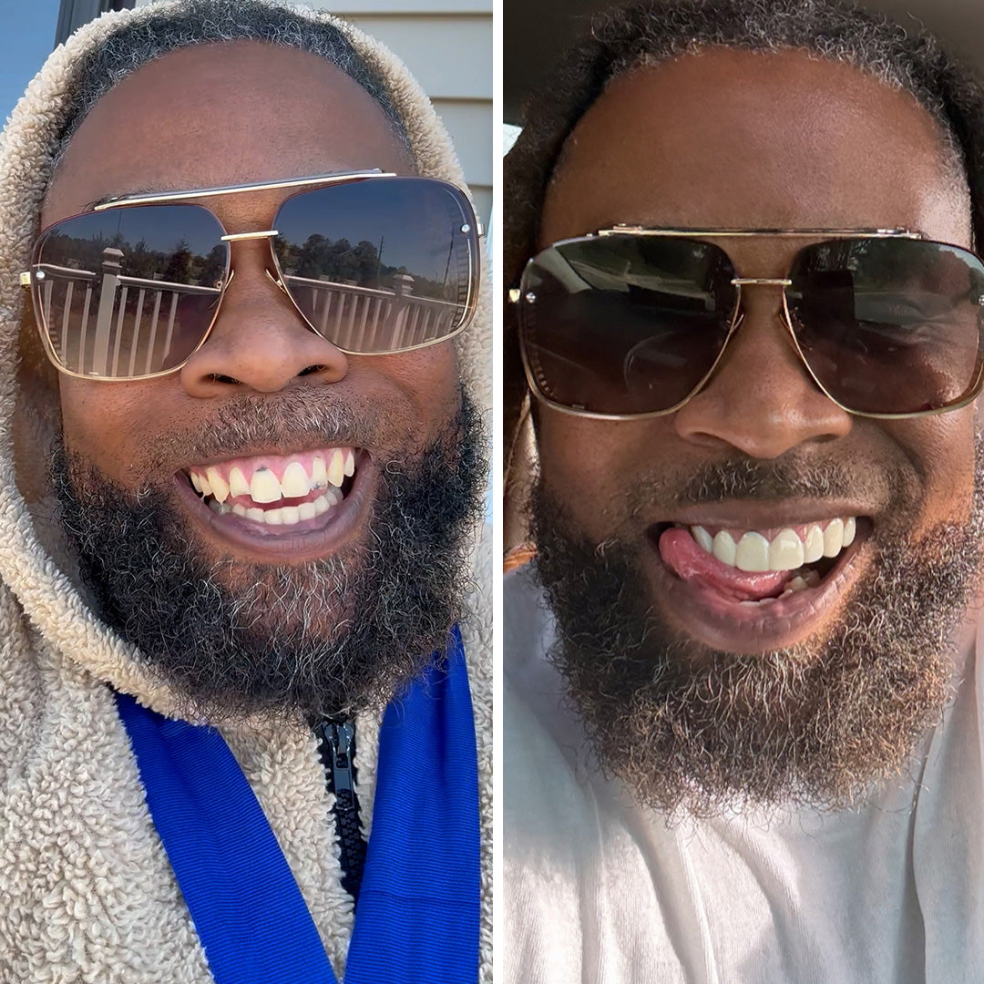 Si estás cansado de tus dientes, ¡cómprate unos nuevos!