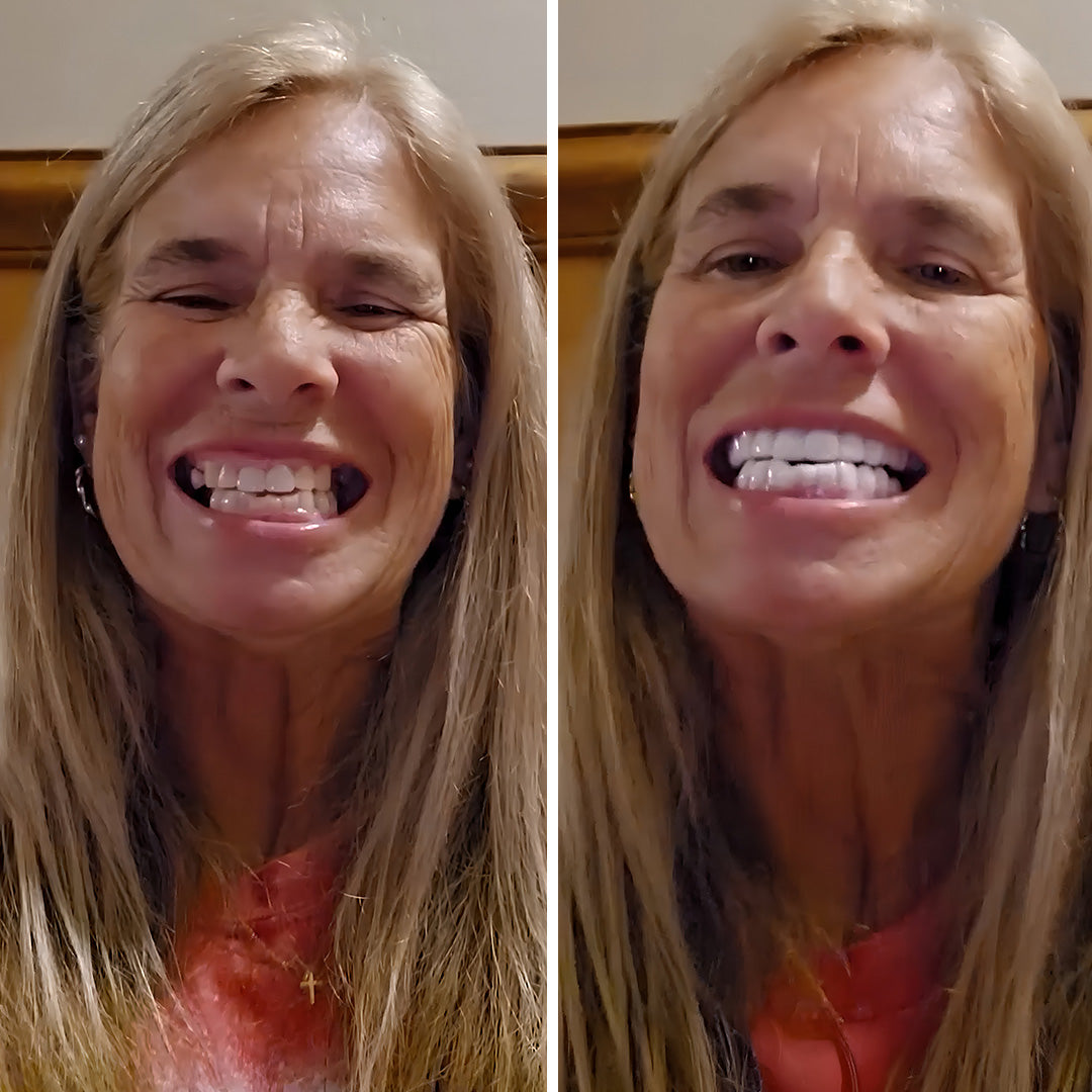Mejora de la sonrisa fácil y asequible
